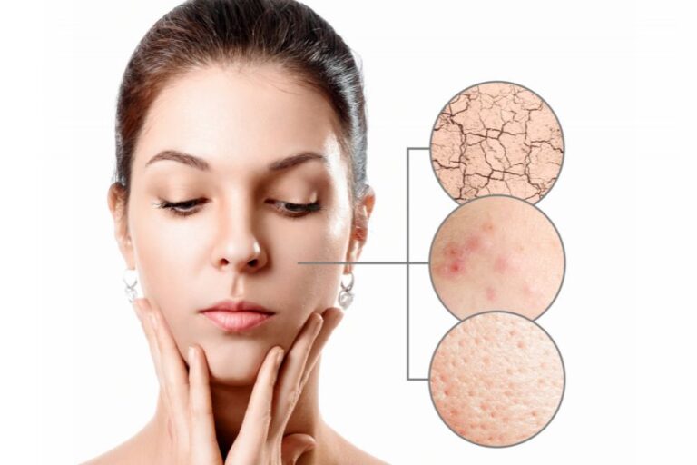 Why Your Skin is Still not Clear