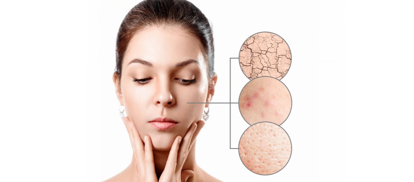 Why Your Skin is Still not Clear